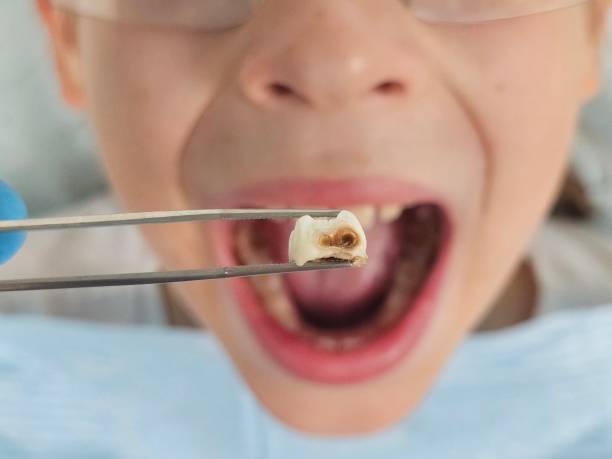 Best Emergency Cosmetic Dentistry (e.g., broken veneers) in Bradford, OH